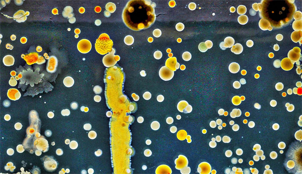 Бактерии на купюрах под микроскопом